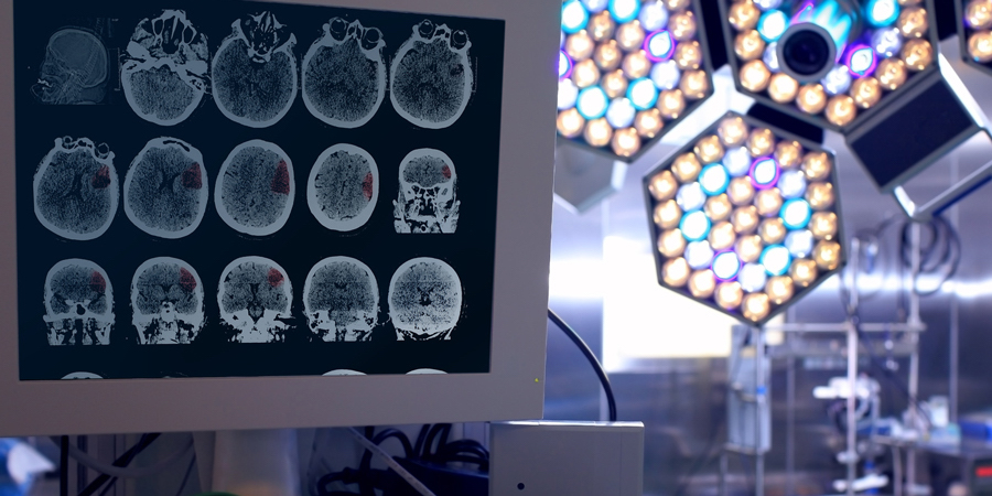 image of brain scans on a screen displayed with operating room lates in the background