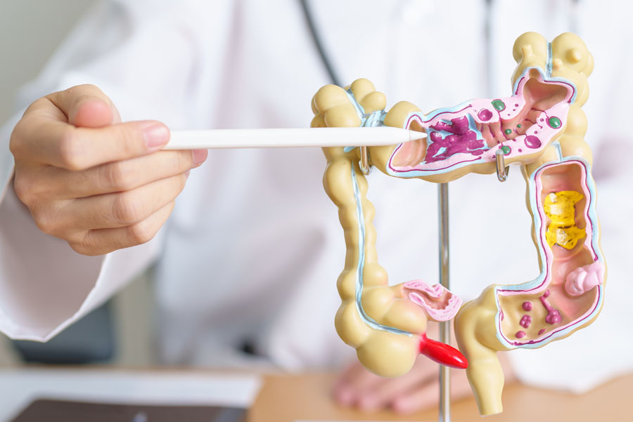 Doctor pointing at human colon anatomy model