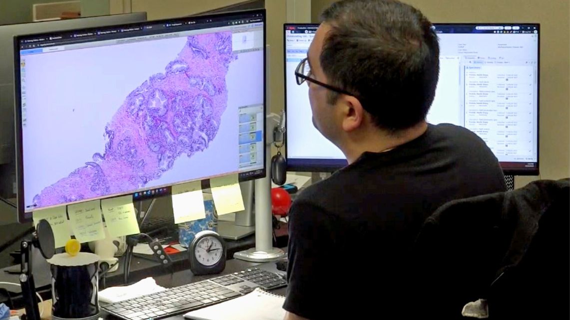 A technician studies a digital image of a prostate biopsy 