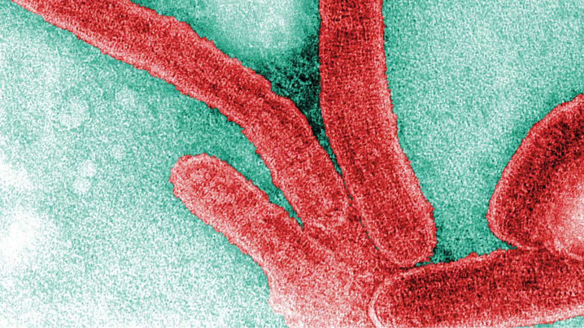 A colorized, negative stained transmission electron microscopic image, captured by F.A. Murphy in 1968, depicts a number of Marburg virus virions, which had been grown in an environment of tissue culture cells. Courtesy of the CDC.
