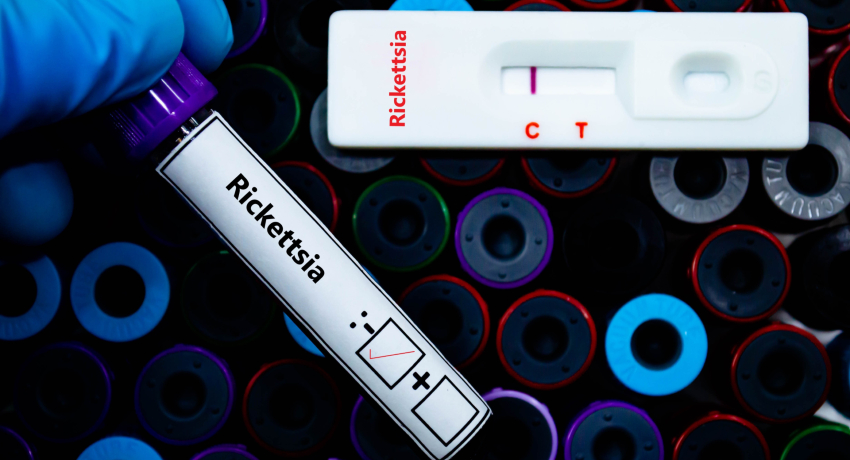 Gloved hand holding a blood sample tube labeled “Rickettsia” next to a rapid test cassette labeled “Rickettsia” with one visible line in the result window, against a background of multicolored specimen tube caps.