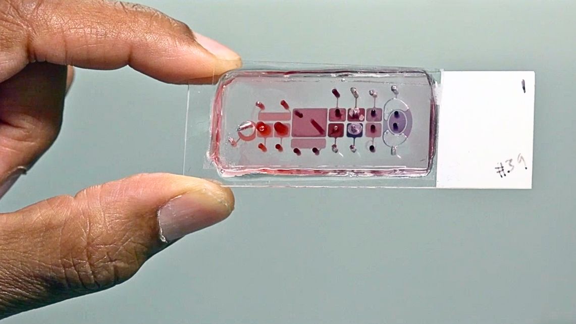 An example of an organ-on-a-chip technology