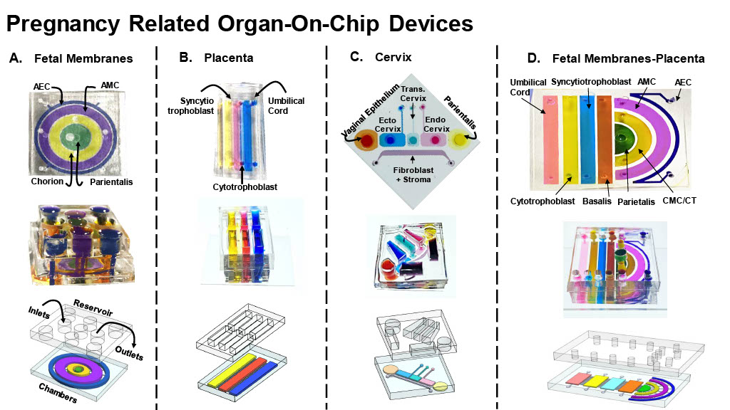 Examples of pregnancy related organ-on-chip devices. colorful illustrations show how researchers put fetal membranes, placenta, cervix and fetla membranes and placenta cells on silicon slides.