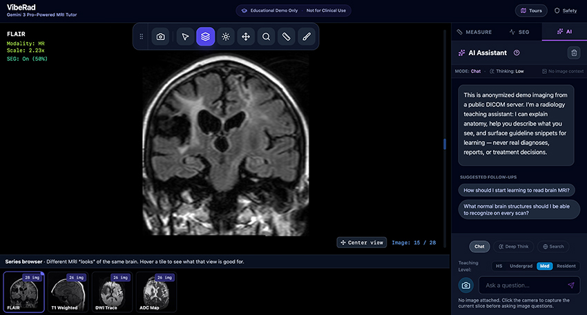 A screenshot shows a series of images of a brain. One image is in the main viewing area. On the right side of the screen, an AI Assistant chat offers several prompts a user might choose to learn about the image. 